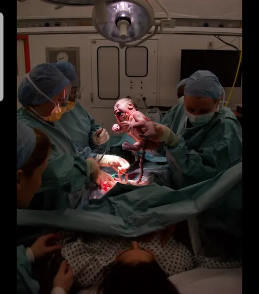 Cesarean section