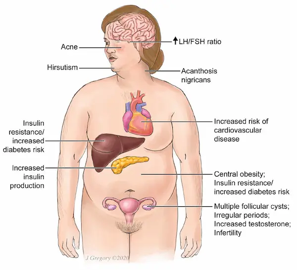  Diagnosis