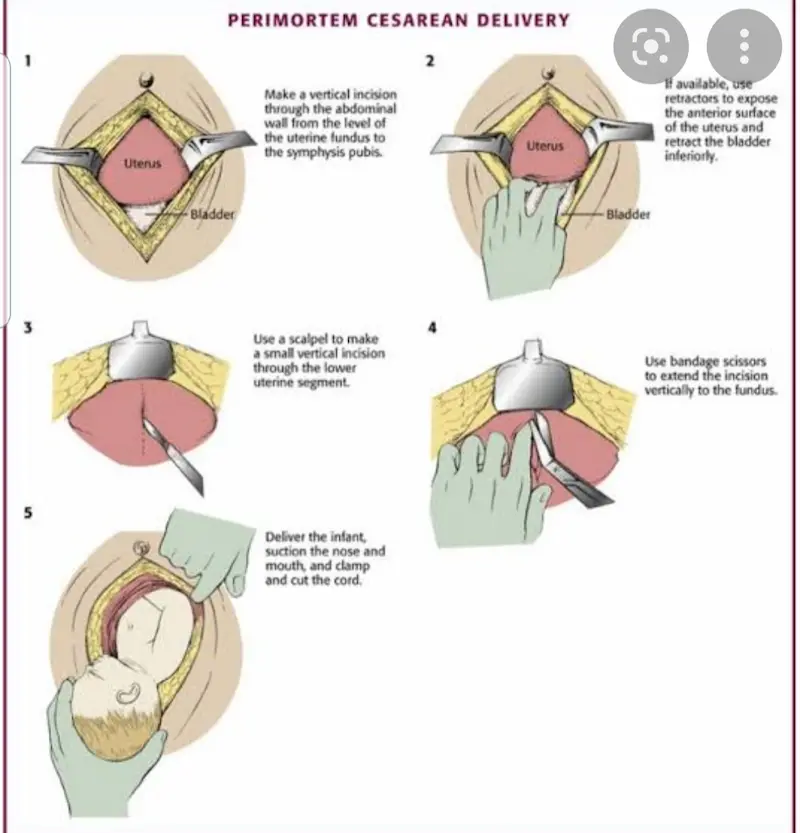 Steps in C section