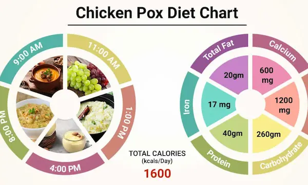 chicken pox diet chart