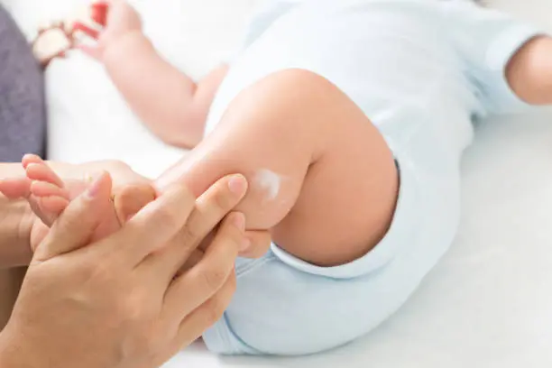 A parent applying a thick cream to a baby’s leg within a minute of bathing