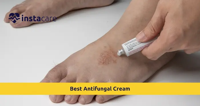 A split image showing a zinc oxide cream for prevention and an antifungal cream for treatment, with labels clearly indicating their purposes