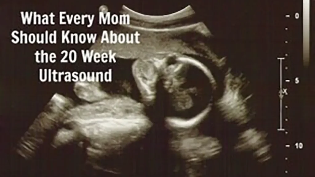 Anatomy Scan at 20 Weeks: What to Expect