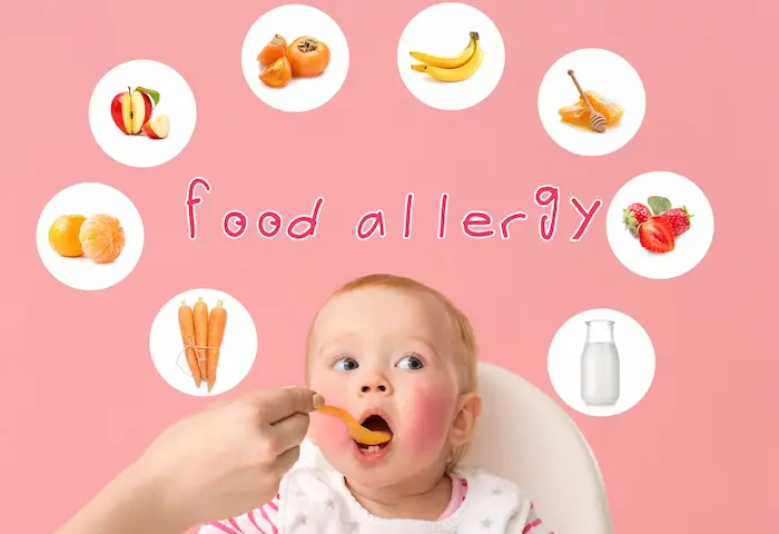 Food Allergies in Babies