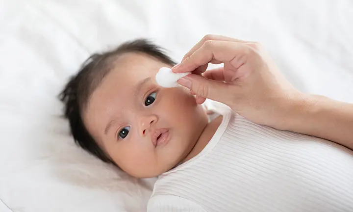 Step-by-step guide: How to safely clean discharge from a newborn's eye