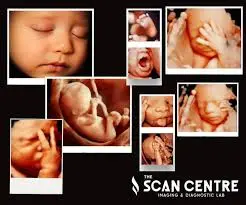 The Scan Unfolds A Moment by Moment Journey
