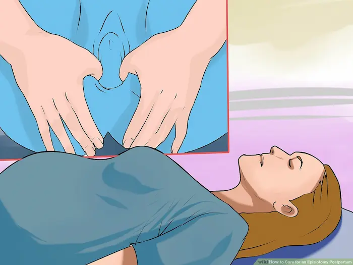 Your Complete Guide to Perineal Tear and Episiotomy Recovery